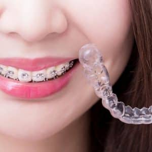 Best Orthodontist In Frisco Texas 19 the role of orthodontics in dental health 3
